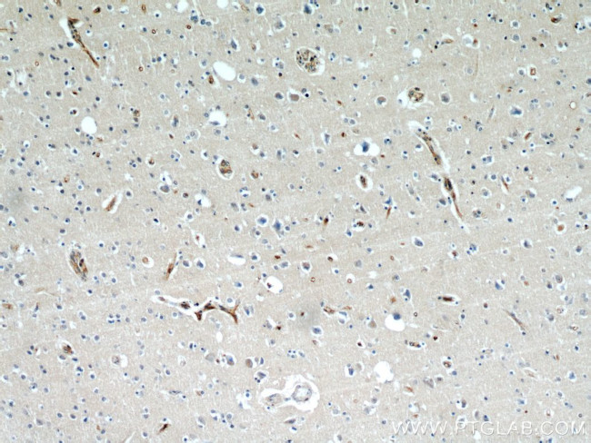 BBS7 Antibody in Immunohistochemistry (Paraffin) (IHC (P))