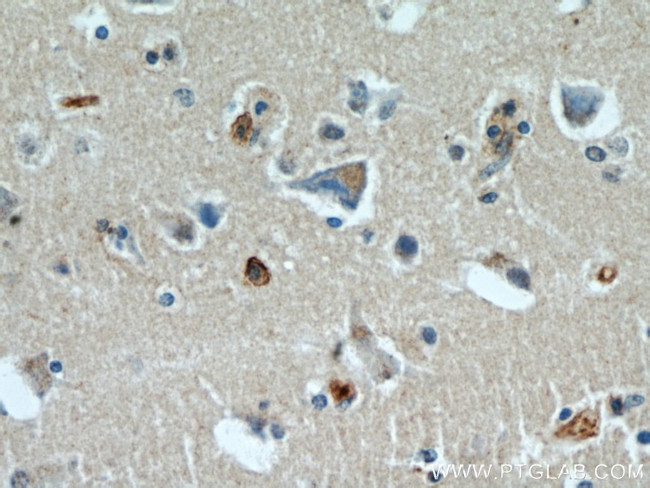 BBS7 Antibody in Immunohistochemistry (Paraffin) (IHC (P))