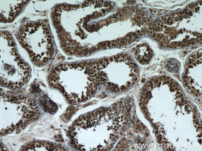 BBS7 Antibody in Immunohistochemistry (Paraffin) (IHC (P))