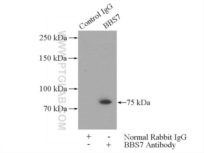 BBS7 Antibody in Immunoprecipitation (IP)