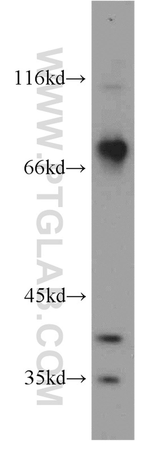 BBS7 Antibody in Western Blot (WB)