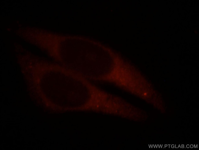 TEKT1 Antibody in Immunocytochemistry (ICC/IF)