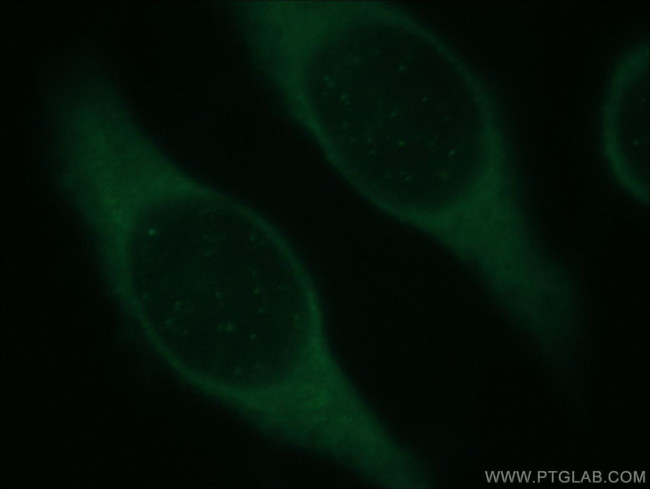 TEKT1 Antibody in Immunocytochemistry (ICC/IF)