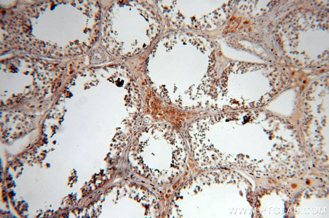 TEKT1 Antibody in Immunohistochemistry (Paraffin) (IHC (P))