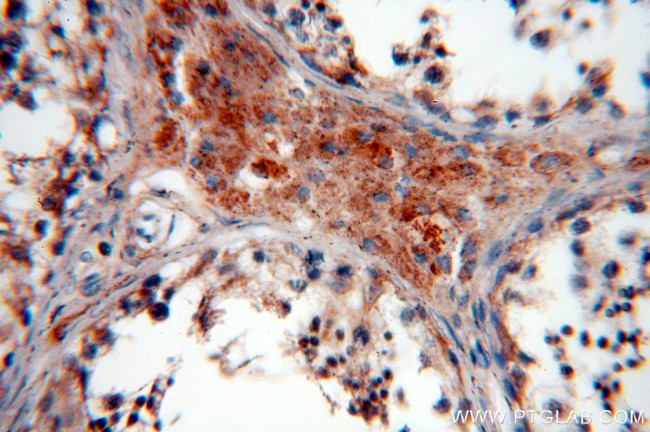 TEKT1 Antibody in Immunohistochemistry (Paraffin) (IHC (P))