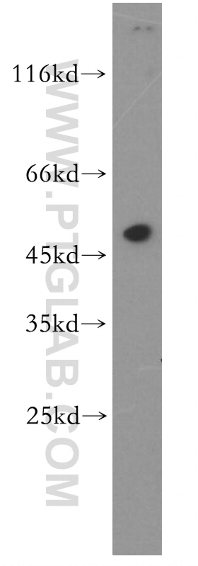 TEKT1 Antibody in Western Blot (WB)