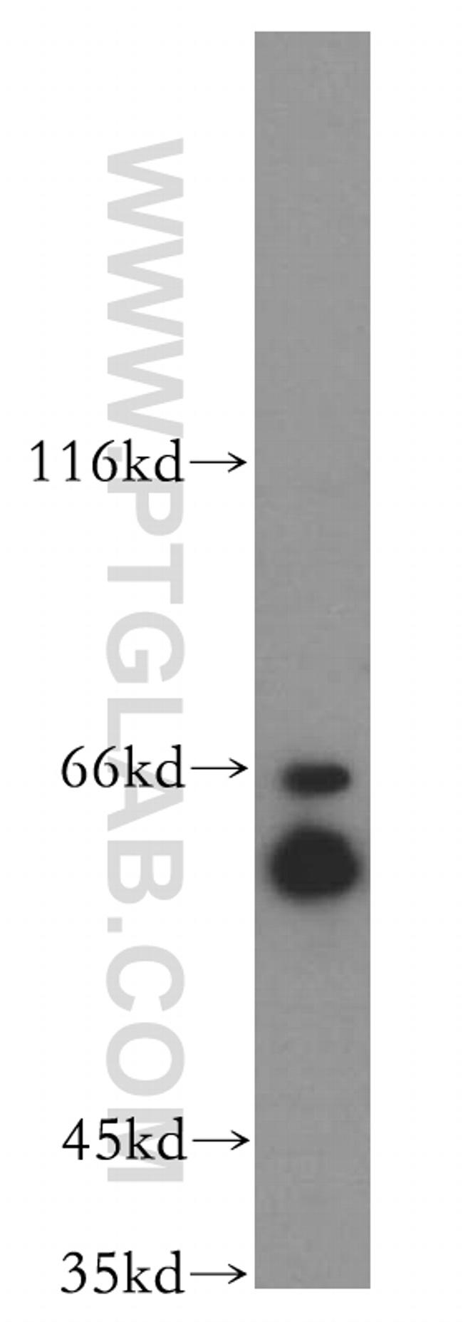 CRMP4 Antibody in Western Blot (WB)