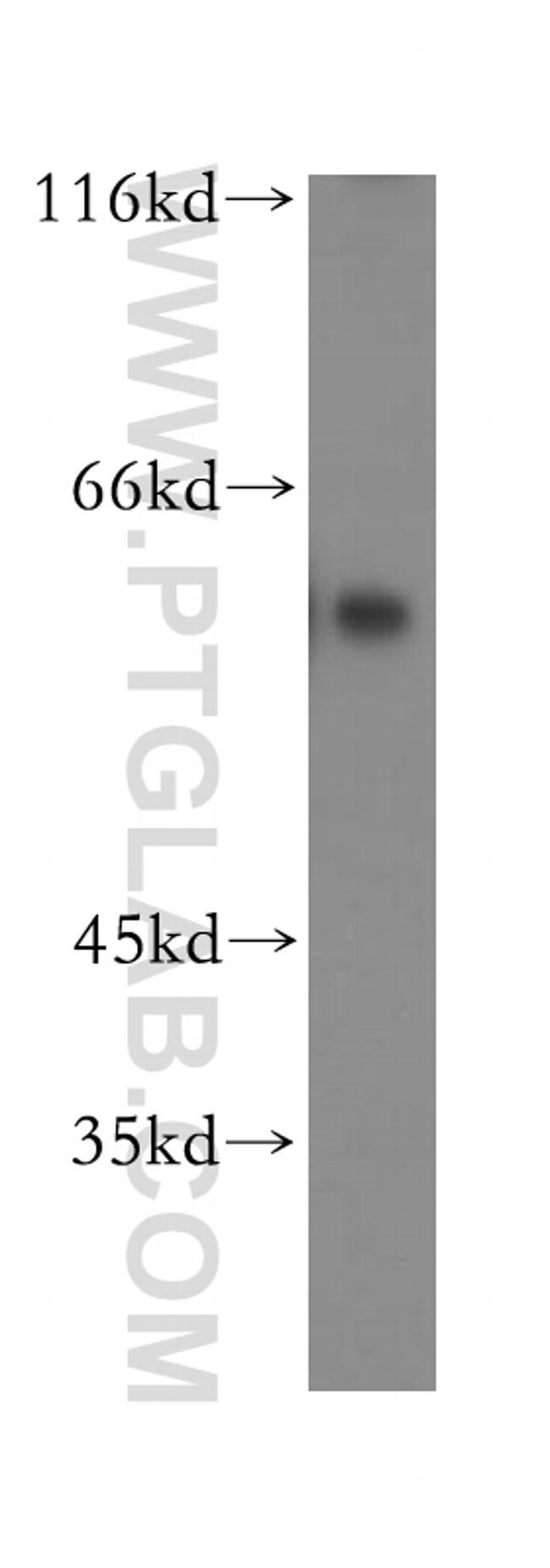 CRMP4 Antibody in Western Blot (WB)