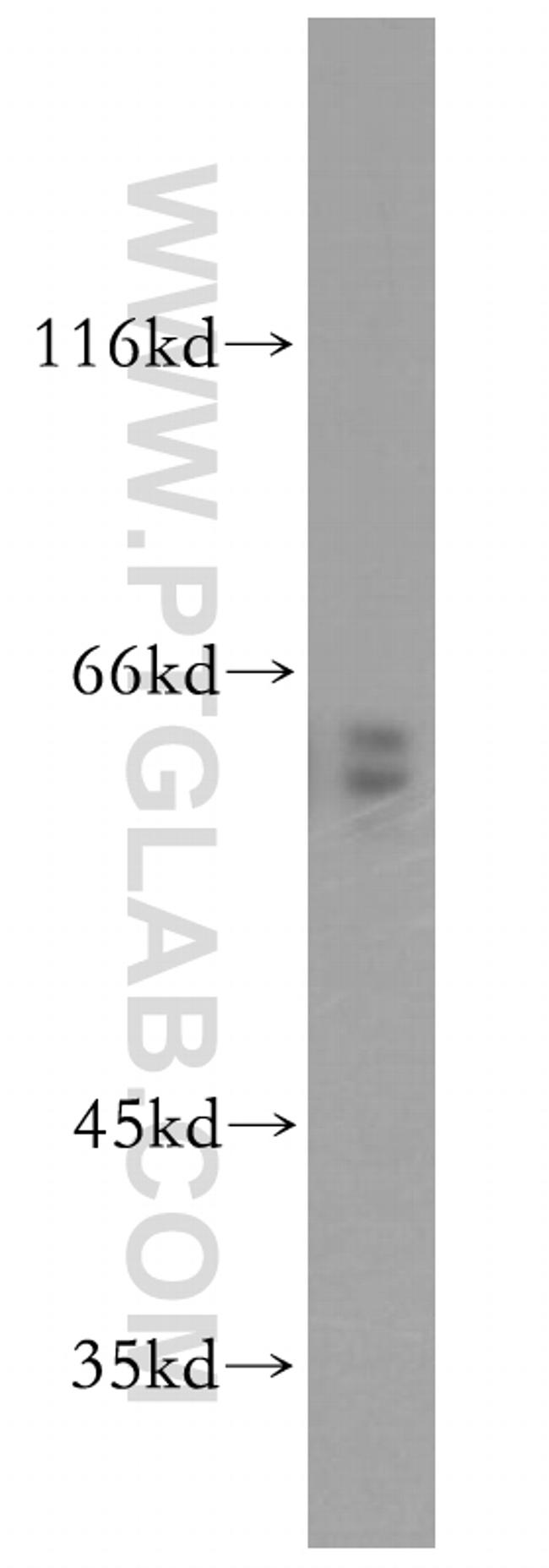 CRMP4 Antibody in Western Blot (WB)