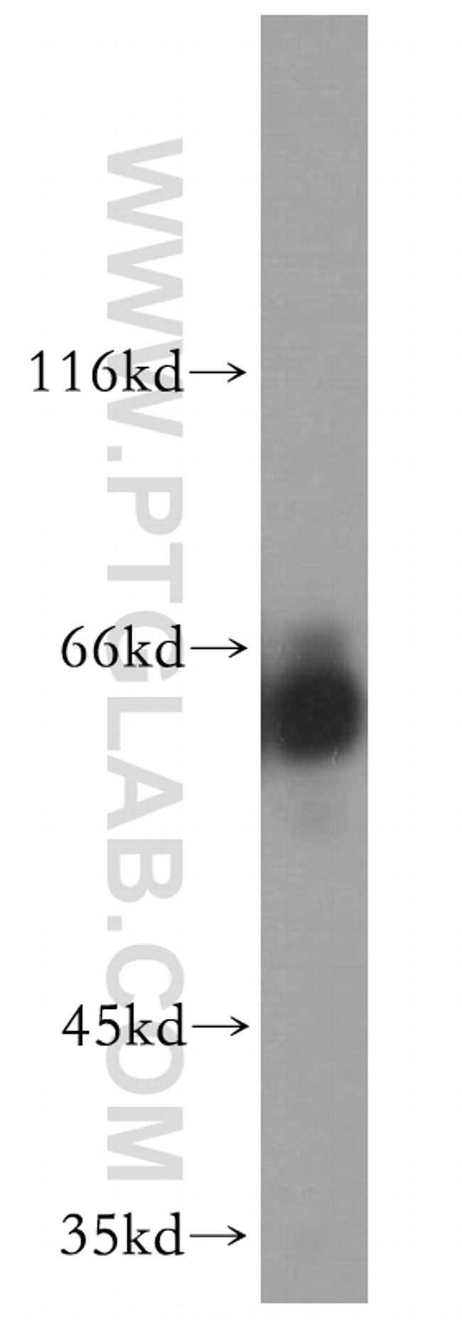 CRMP4 Antibody in Western Blot (WB)