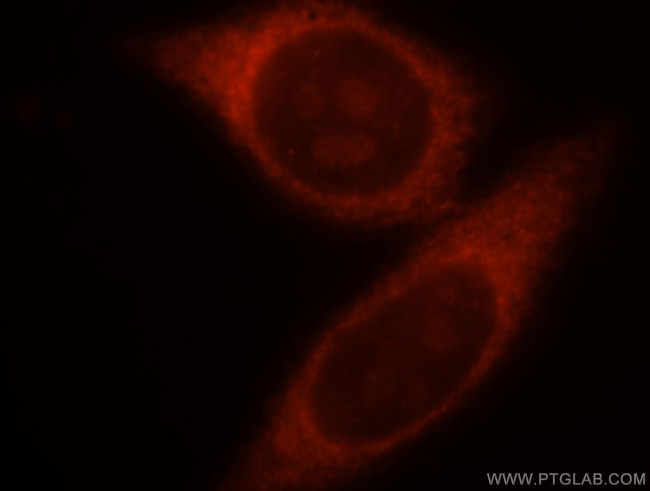 CRMP4 Antibody in Immunocytochemistry (ICC/IF)