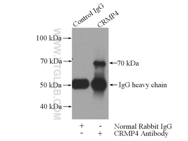 CRMP4 Antibody in Immunoprecipitation (IP)