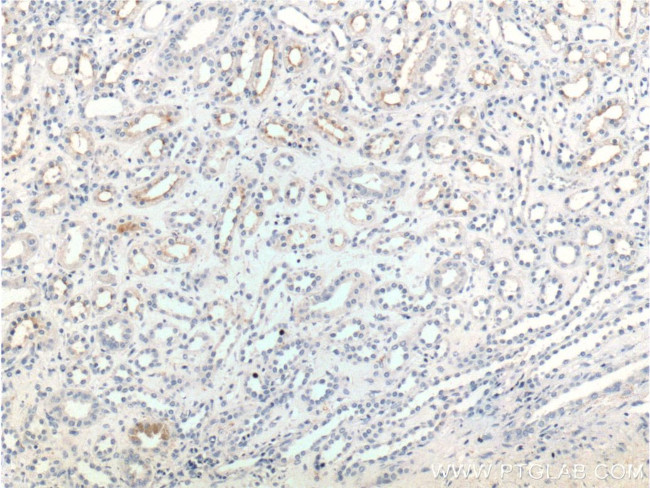 NKCC2 Antibody in Immunohistochemistry (Paraffin) (IHC (P))