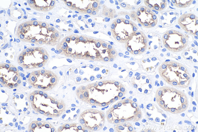 NKCC2 Antibody in Immunohistochemistry (Paraffin) (IHC (P))