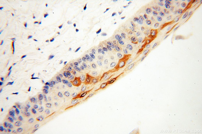 TULP1 Antibody in Immunohistochemistry (Paraffin) (IHC (P))