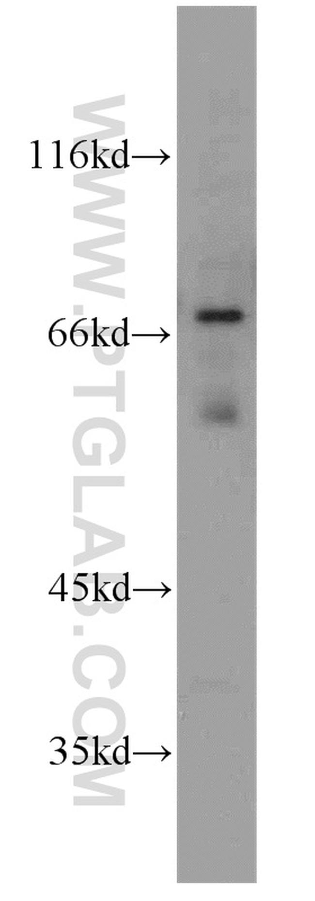 TULP1 Antibody in Western Blot (WB)