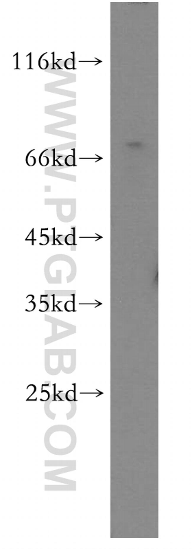 TULP1 Antibody in Western Blot (WB)