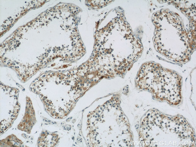 PAOX Antibody in Immunohistochemistry (Paraffin) (IHC (P))