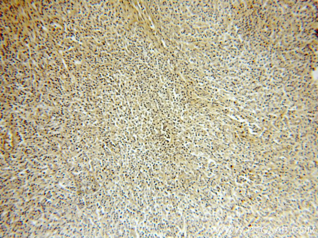 IRF8 Antibody in Immunohistochemistry (Paraffin) (IHC (P))