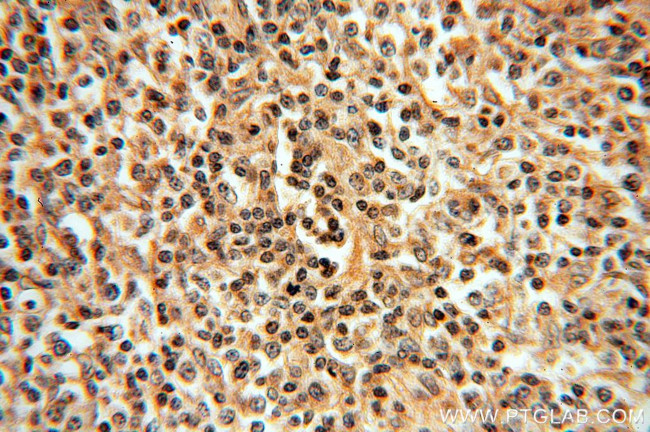 IRF8 Antibody in Immunohistochemistry (Paraffin) (IHC (P))