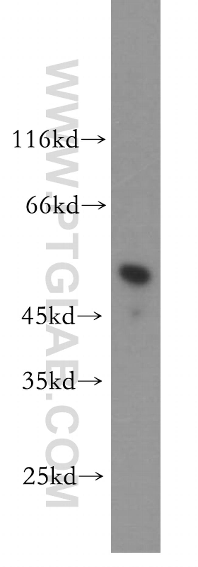 IRF8 Antibody in Western Blot (WB)