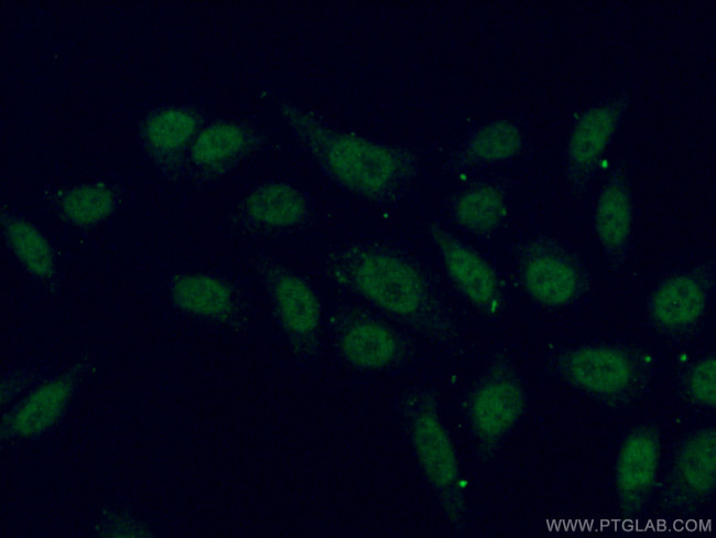 ZCCHC11 Antibody in Immunocytochemistry (ICC/IF)