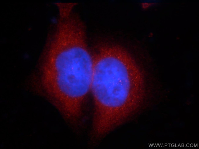 ZCCHC11 Antibody in Immunocytochemistry (ICC/IF)