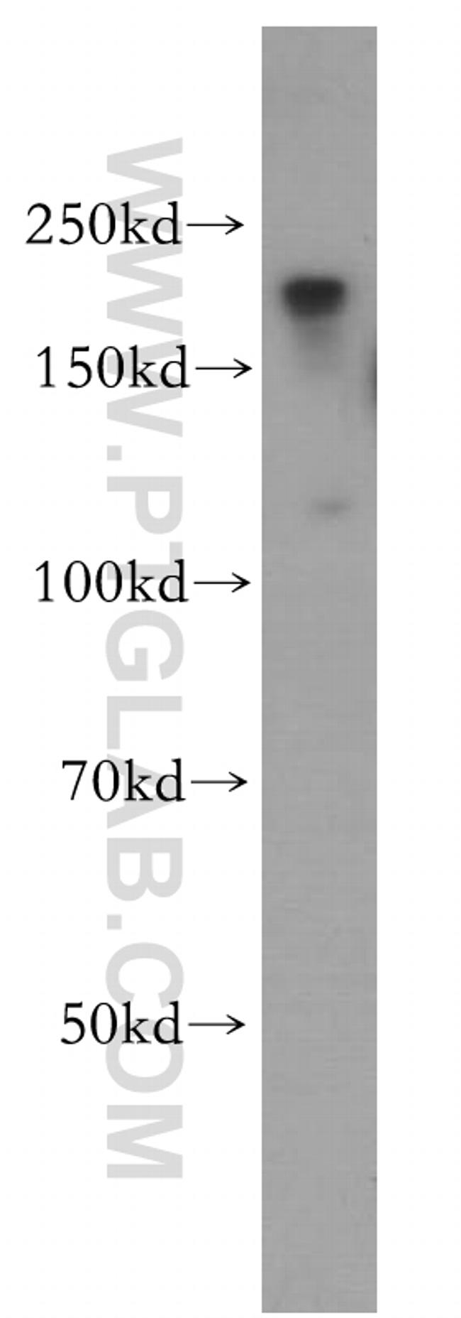 ZCCHC11 Antibody in Western Blot (WB)