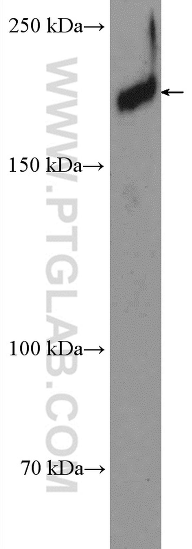 ZCCHC11 Antibody in Western Blot (WB)