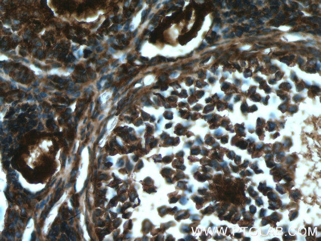 BMP15 Antibody in Immunohistochemistry (Paraffin) (IHC (P))