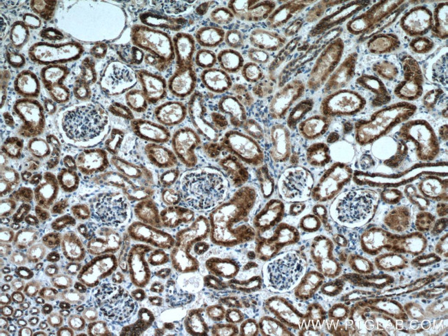 nNOS Antibody in Immunohistochemistry (Paraffin) (IHC (P))