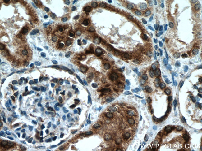 nNOS Antibody in Immunohistochemistry (Paraffin) (IHC (P))