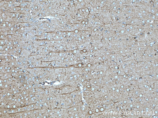 nNOS Antibody in Immunohistochemistry (Paraffin) (IHC (P))