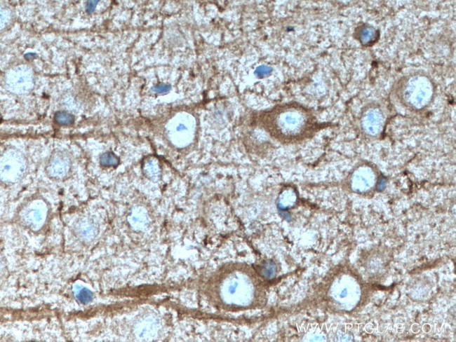 nNOS Antibody in Immunohistochemistry (Paraffin) (IHC (P))