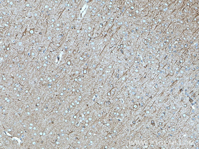 nNOS Antibody in Immunohistochemistry (Paraffin) (IHC (P))