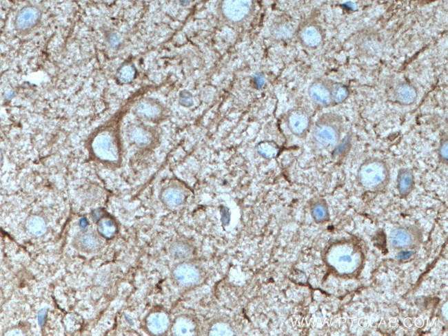 nNOS Antibody in Immunohistochemistry (Paraffin) (IHC (P))