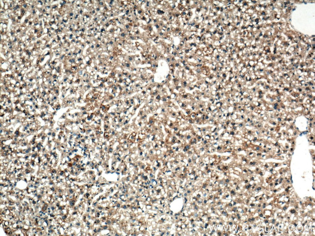 iNOS Antibody in Immunohistochemistry (Paraffin) (IHC (P))