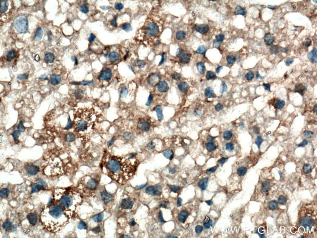 iNOS Antibody in Immunohistochemistry (Paraffin) (IHC (P))