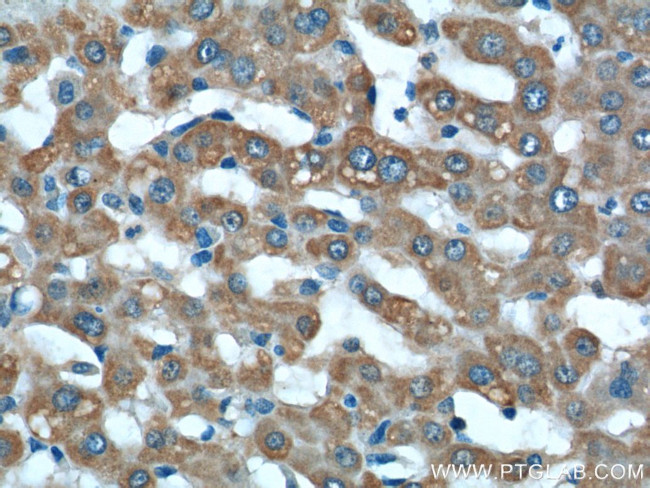 iNOS Antibody in Immunohistochemistry (Paraffin) (IHC (P))