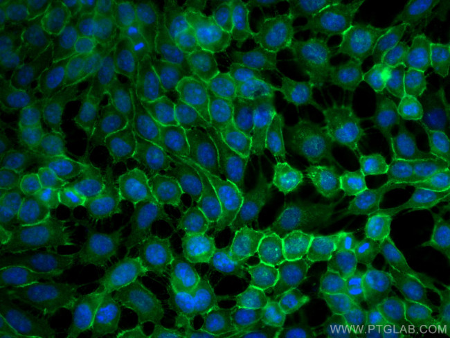 EGFR Antibody in Immunocytochemistry (ICC/IF)