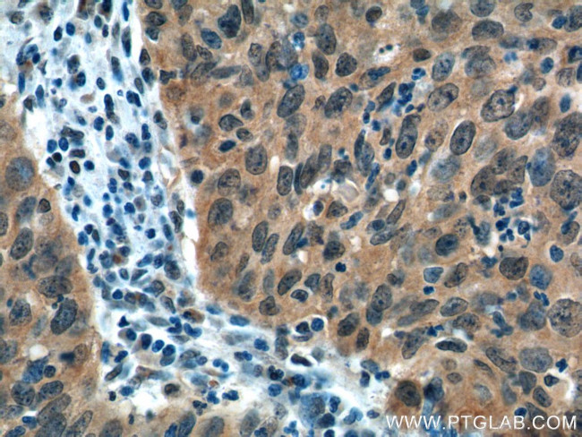 EGFR Antibody in Immunohistochemistry (Paraffin) (IHC (P))