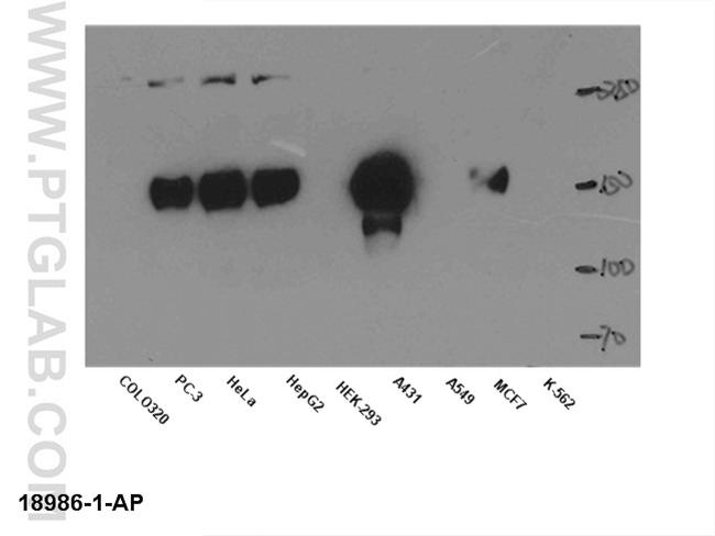 EGFR Antibody in Western Blot (WB)