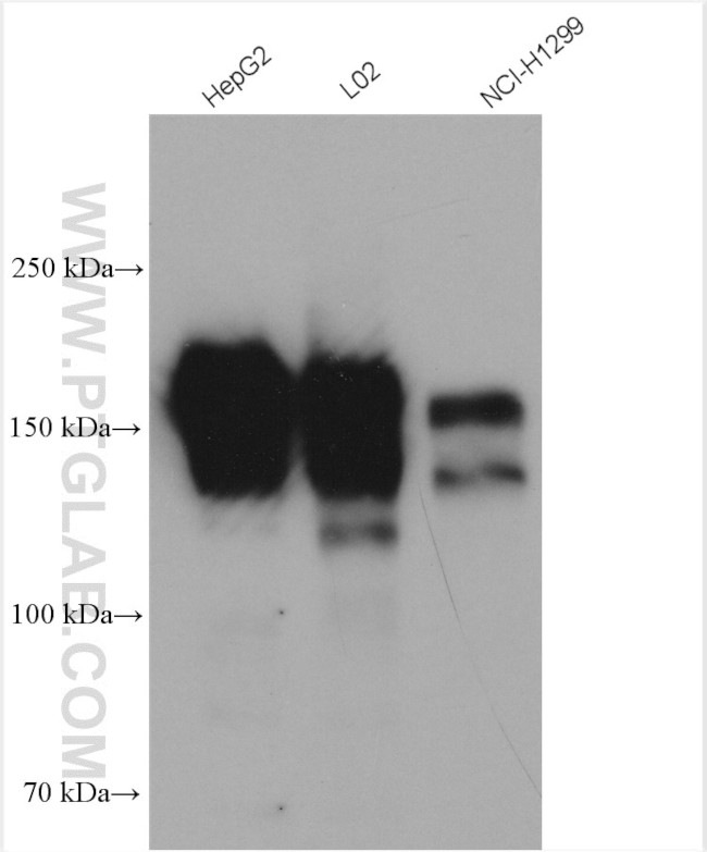 EGFR Antibody in Western Blot (WB)