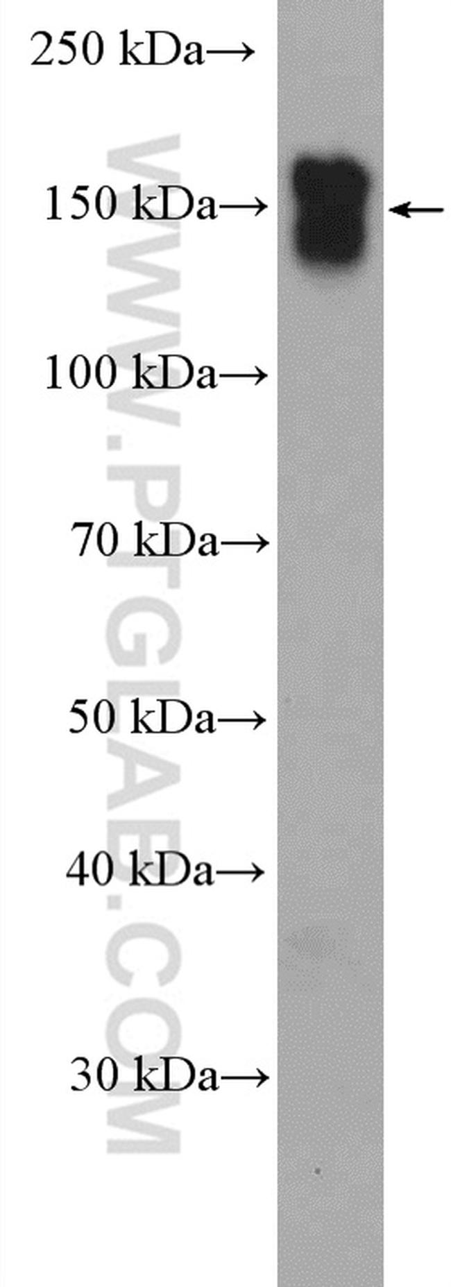 EGFR Antibody in Western Blot (WB)