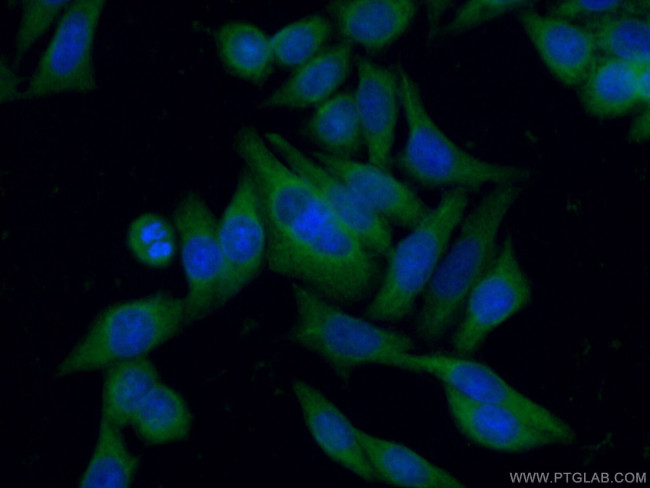 DOCK9 Antibody in Immunocytochemistry (ICC/IF)