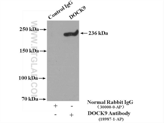 DOCK9 Antibody in Immunoprecipitation (IP)