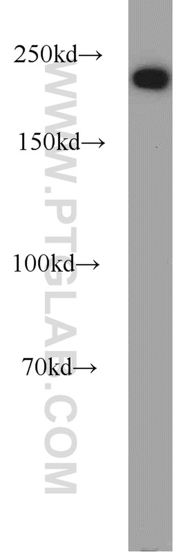 DOCK9 Antibody in Western Blot (WB)