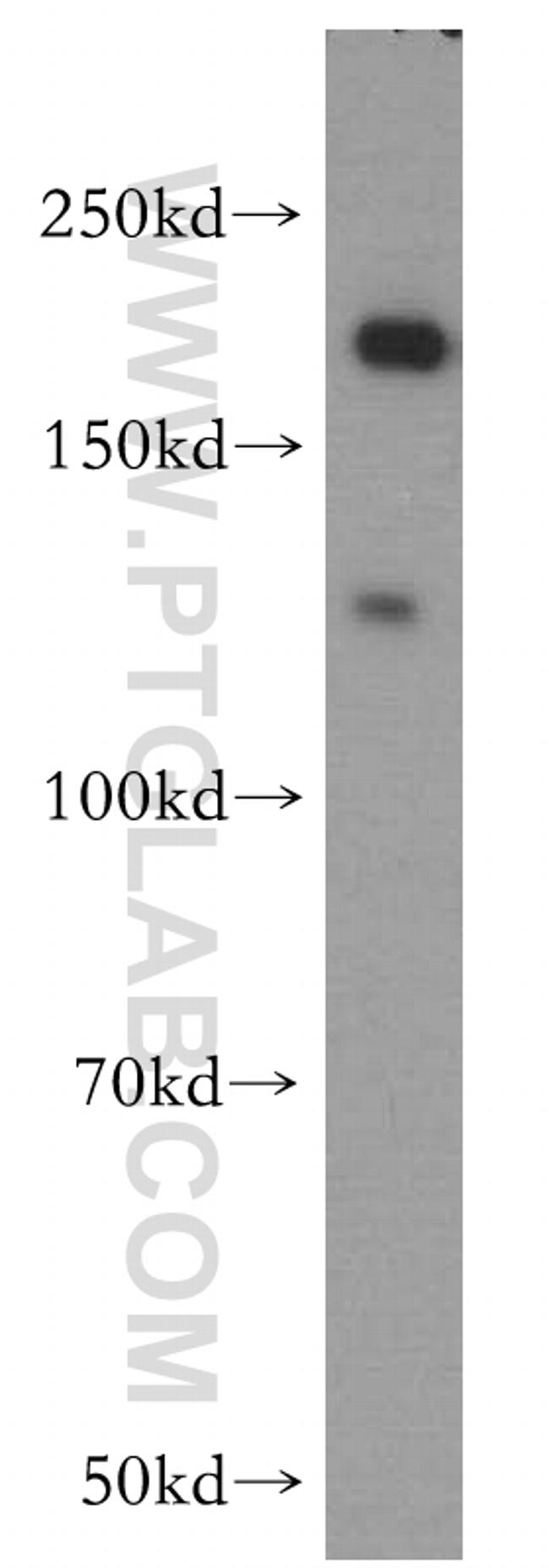 DOCK9 Antibody in Western Blot (WB)