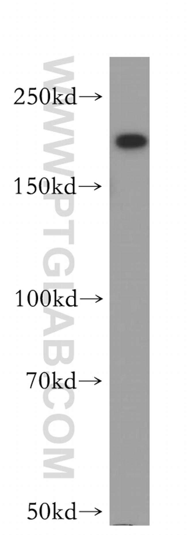 DOCK9 Antibody in Western Blot (WB)