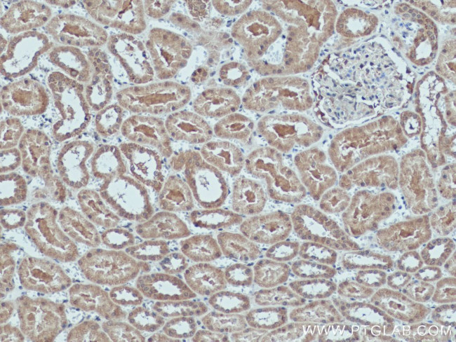 GLI2 Antibody in Immunohistochemistry (Paraffin) (IHC (P))